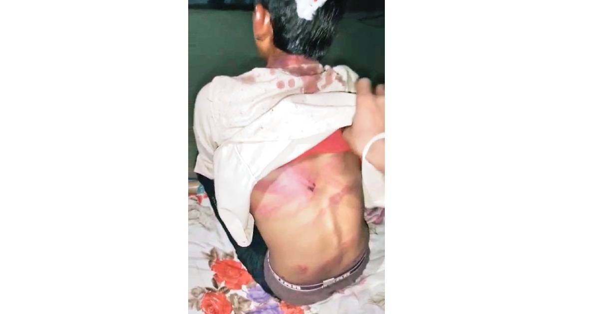 Dalit minor boy hung upside down, beaten with hot iron rods